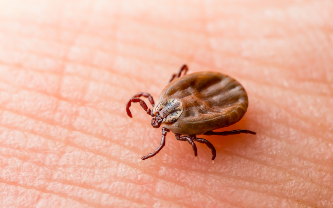 What is Rocky Mountain Spotted Fever (RMSF)? 
